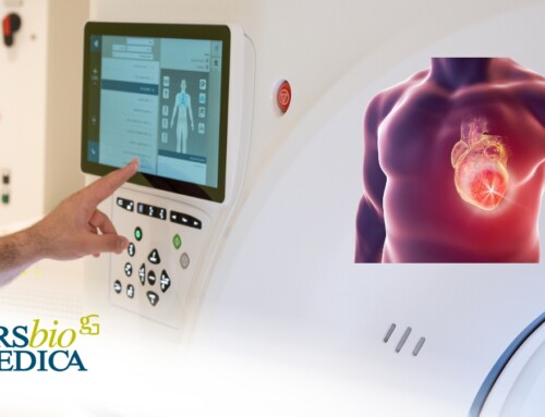 Cardio Tc a chi serve davvero e quando farla?