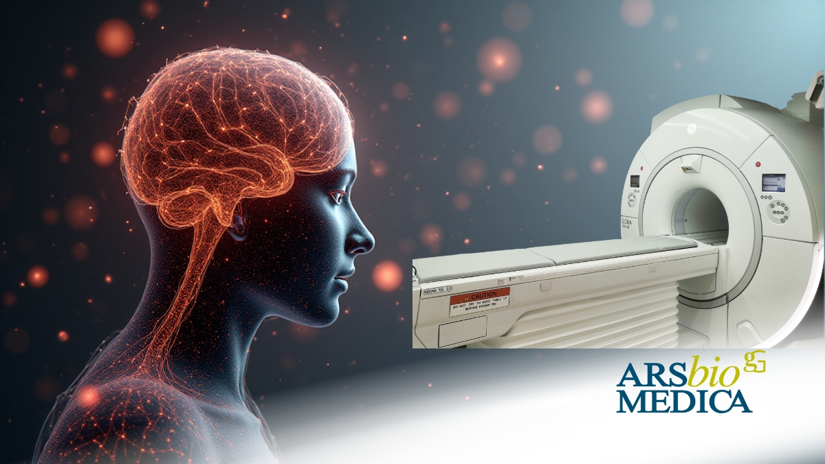 risonanza magnetica encefalo a cosa serve risonanza magnetica encefalo a cosa serve