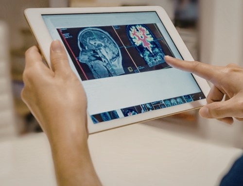 Update in Diagnostica per Immagini: Correlazione tra Clinica e Imaging nelle Patologie della Spalla.